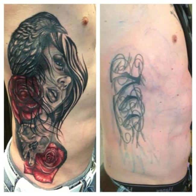 cover up Na costela 1 cover up Na costela 1